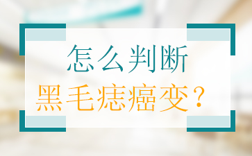 广州胎记医院排名-黑毛痣的最佳治疗时间是什么时候？