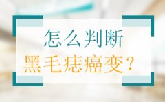 胎记是怎样得来的-广州胎记医生-黑毛痣的形成原因是什么